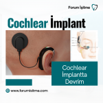 Cochlear İmplant  Instagram Post.png