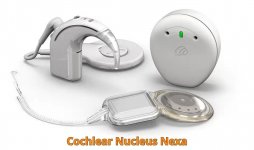 Cochlear Nucleus Nexa.jpg